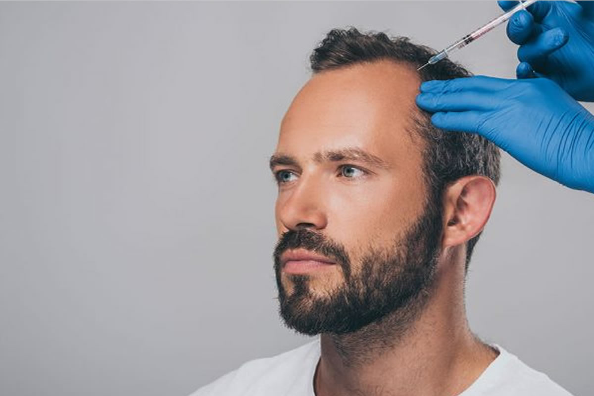 PRP hair restoration